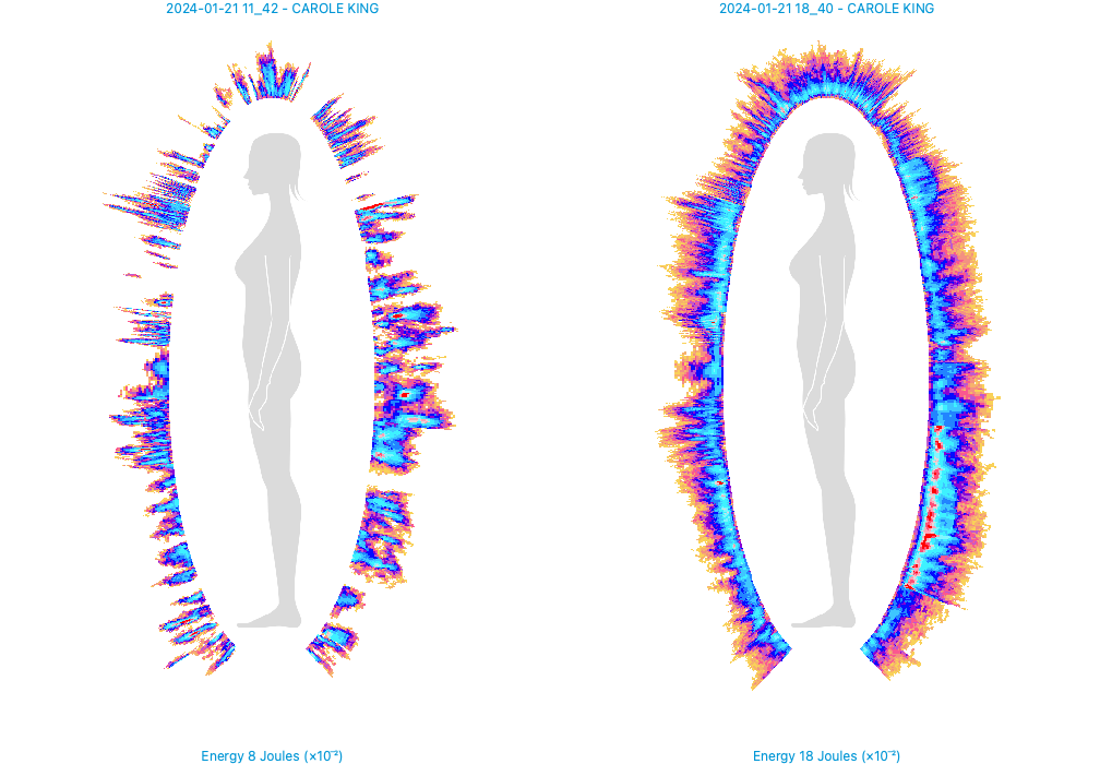 Bio-Well 3.0 Kirlian Fotografie Kamera